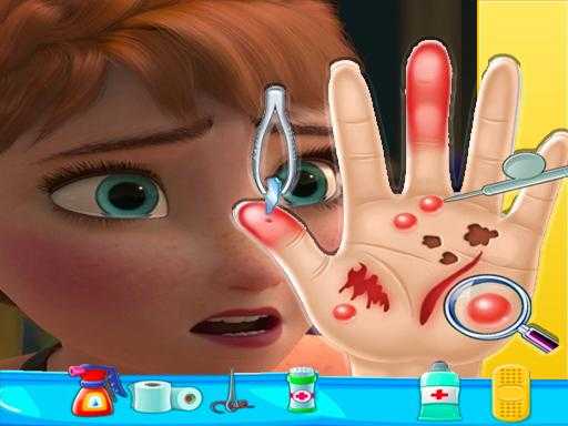 Anna frozen Hand Doctor Fun Games for Girls Onlin